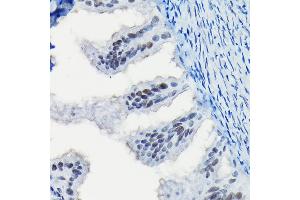 Immunohistochemistry of paraffin-embedded rat fallopian tube using Progesterone Receptor Rabbit pAb (ABIN6128570, ABIN6145518, ABIN6145519 and ABIN6213802) at dilution of 1:100 (40x lens). (Progesterone Receptor 抗体  (AA 1-250))