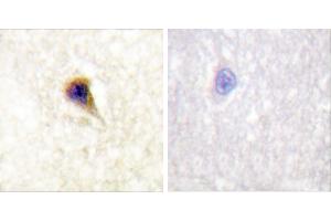 P-peptide - +Immunohistochemical analysis of paraffin-embedded human brain tissue using FAK (Phospho-Tyr576) Antibody (#A0426). (FAK 抗体  (pTyr576))