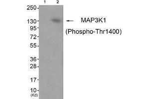 Western blot analysis of extracts from JK cells (Lane 2), using MAP3K1 (Phospho-Thr1400) Antibody. (MAP3K1 抗体  (pThr1402))
