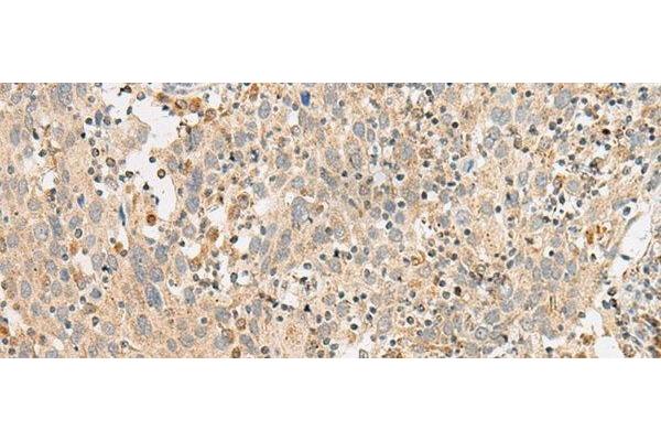 G Protein-Coupled Receptor 119 抗体