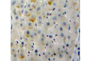 Used in DAB staining on fromalin fixed paraffin-embedded Liver tissue (CD79b 抗体  (AA 37-226))