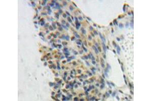 Used in DAB staining on fromalin fixed paraffin-embedded Ovary tissue (GTF2E1 抗体  (AA 15-306))