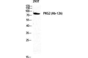 Western Blot (WB) analysis of 293T cells using cGKII Polyclonal Antibody. (PRKG2 抗体  (Ser363, Thr359))