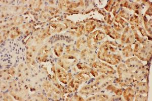 Anti-CISH antibody, IHC(P) IHC(P): Rat Kidney Tissue (CISH 抗体  (C-Term))