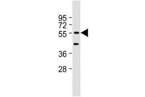 Western blot testing of mouse NIH3T3 cell lysate with DNAJC3 antibody at 1:2000. (DNAJC3 抗体  (AA 189-223))