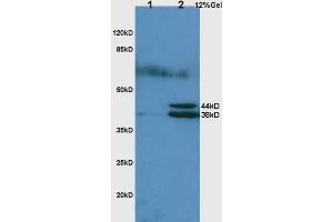 L1 rat lung lysates L2 rat liver lysates probed with Anti Hpt/Haptoglobin Polyclonal Antibody, Unconjugated (ABIN734738) at 1:200 in 4 °C. (Haptoglobin 抗体  (AA 251-350))