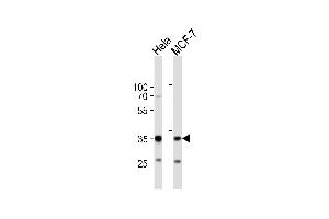 Western blot analysis of lysates from Hela, MCF-7 cell line (from left to right), using SNAI1 Antibody (N-term R8) (ABIN388812 and ABIN2839130).
