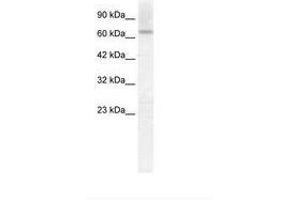 Image no. 1 for anti-Protein Inhibitor of Activated STAT, 2 (PIAS2) (C-Term) antibody (ABIN202826) (PIAS2 抗体  (C-Term))