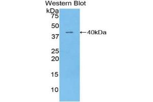 Western blot analysis of the recombinant protein. (TNNT1 抗体  (AA 1-259))