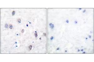 Immunohistochemistry analysis of paraffin-embedded human brain, using Amyloid beta A4 (Ab-743/668) Antibody. (APP 抗体  (AA 711-760))