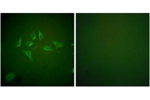 Immunofluorescence analysis of HepG2 cells, using iNOS Antibody.