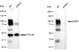 Western blotting analysis using LAMP1 antibody (ABIN7799308).