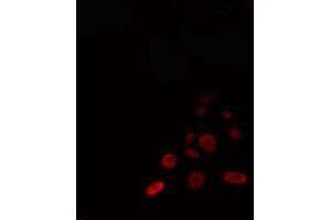 ABIN6274342 staining 293 cells by IF/ICC. (TOP3A 抗体  (C-Term))