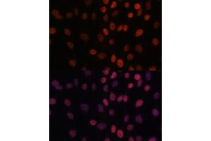 Immunofluorescence (IF) image for anti-AT Rich Interactive Domain 1B (SWI1-Like) (ARID1B) (AA 400-650) antibody (ABIN7265702)