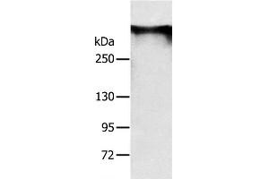 Western Blot analysis of Mouse brain tissue using RYR1 Polyclonal Antibody at dilution of 1:300 (RYR1 抗体)