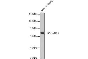 Western blot analysis of extracts of Mouse kidney, using K/K/Elp3 antibody (ABIN6130883, ABIN6140142, ABIN6140143 and ABIN6225217) at 1:1000 dilution. (ELP3/KAT9 抗体  (AA 358-547))