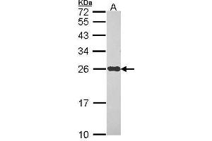 WB Image Sample (30 ug of whole cell lysate) A: Hep G2 , 12% SDS PAGE NDUFS8 antibody antibody diluted at 1:1000