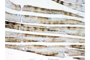 IHC testing of FFPE rat skeletal muscle with ACTN3 antibody at 1ug/ml. (ACTN3 抗体  (AA 574-617))