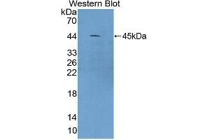 Western blot analysis of the recombinant protein. (CAMK1 抗体  (AA 1-370))