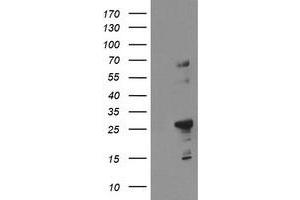 Image no. 1 for anti-Spastic Paraplegia 7 (SPG7) (AA 300-573) antibody (ABIN1491376) (SPG7 抗体  (AA 300-573))
