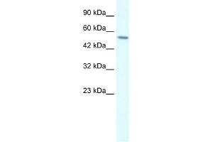 WB Suggested Anti-RGS6 Antibody Titration:  0. (RGS6 抗体  (C-Term))