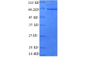 SDS-PAGE (SDS) image for Calcium-Sensing Receptor (CASR) (AA 20-612) protein (His tag) (ABIN5713312)