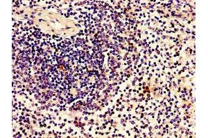 Immunohistochemistry (IHC) image for anti-Zinc Finger and BTB Domain Containing 8 Opposite Strand (ZBTB8OS) (AA 2-136) antibody (ABIN7165052)