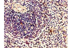 Immunohistochemistry of paraffin-embedded human spleen tissue using ABIN7165052 at dilution of 1:100 (ZBTB8OS 抗体  (AA 2-136))