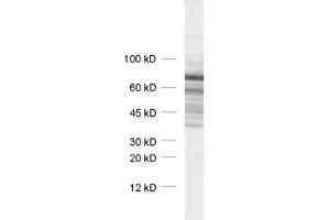 dilution: 1 : 1000, sample: synaptic vesicle fraction of rat brain (LP2) (Synapsin III 抗体  (AA 417-434))