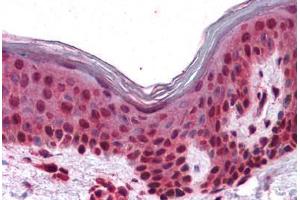 Immunohistochemistry (Formalin-fixed Paraffin-embedded Sections) (IHC (fp)) image for anti-Solute Carrier Family 5 (Iodide Transporter), Member 6 (SLC5A6) (N-Term) antibody (ABIN625852)