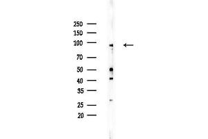anti-Breast Cancer Anti-Estrogen Resistance 3 (BCAR3) (C-Term) antibody