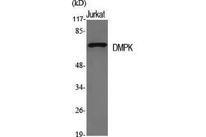 Western Blotting (WB) image for anti-Dystrophia Myotonica-Protein Kinase (DMPK) (N-Term) antibody (ABIN3174775) (DMPK 抗体  (N-Term))