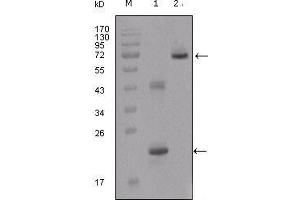Western Blot showing IGFBP2 antibody used against truncated IGFBP2-His recombinant protein (1) and truncated IGFBP2 (aa40-328)-hIgGFc transfected CHO-K1 cell lysate (2). (IGFBP2 抗体  (AA 180-328))