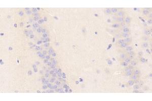 Immunohistochemistry (IHC) image for anti-Nitric Oxide Synthase 1 (Neuronal) Adaptor Protein (NOS1AP) (AA 19-251) antibody (ABIN7443713)