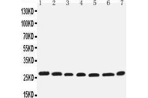 Western Blotting (WB) image for anti-Eukaryotic Translation Initiation Factor 6 (EIF6) (AA 82-96), (Middle Region) antibody (ABIN3044059) (EIF6 抗体  (Middle Region))