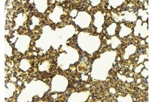 ABIN6276873 at 1/100 staining Mouse lung tissue by IHC-P. (GGT1 抗体  (N-Term))