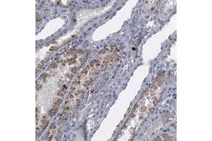 Immunohistochemical staining of human kidney with MYO18B polyclonal antibody  shows moderate cytoplasmic positivity in renal tubules. (MYO18B 抗体)
