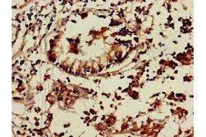 Immunohistochemistry of paraffin-embedded human appendix tissue using ABIN7172340 at dilution of 1:100 (TNIK 抗体  (AA 523-714))