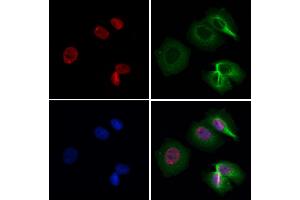 ABIN6258503 and ABIN6274617 staining Hela by IF/ICC. (CDCA7 抗体  (Internal Region))