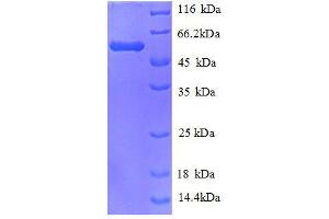 Carbonyl Reductase 1 (CBR1) (AA 2-277), (full length) protein (GST tag) (CBR1 Protein (AA 2-277, full length) (GST tag))