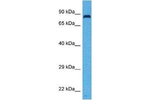 Host:  Rabbit  Target Name:  SLC26A4  Sample Tissue:  Human Ovary Tumor  Antibody Dilution:  1ug/ml