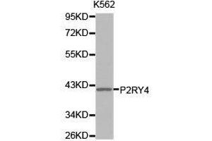 Western Blotting (WB) image for anti-Pyrimidinergic Receptor P2Y, G-Protein Coupled, 4 (P2RY4) antibody (ABIN1874015) (P2RY4 抗体)