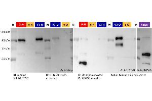 Western Blotting (WB) image for anti-Transient Receptor Potential Cation Channel, Subfamily V, Member 3 (TRPV3) (AA 458-474) antibody (ABIN863127)