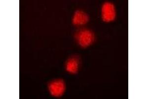 Immunofluorescent analysis of BRG1 staining in Hela cells. (SMARCA4 抗体)