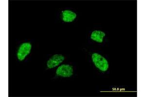Immunofluorescence of purified MaxPab antibody to A1CF on HeLa cell. (A1CF 抗体  (AA 1-594))
