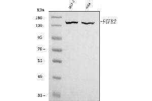 Western blot analysis of FGFR2 using anti-FGFR2 antibody (ABIN7600690).