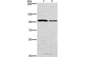 Western blot analysis of NIH/3T3 and A172 cell, using CARD14 Polyclonal Antibody at dilution of 1:800 (CARD14 抗体)