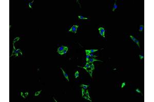 Immunofluorescence staining of MCF-7 cells with ABIN7167210 at 1:100, counter-stained with DAPI. (MRAS 抗体  (AA 1-205))