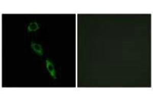 Immunofluorescence analysis of A549 cells, using ERAS antibody. (ERAS 抗体  (C-Term))