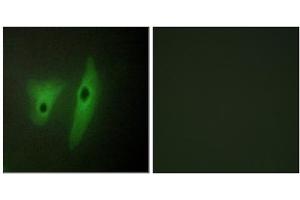 Immunofluorescence analysis of HeLa cells, using DUS19 antibody. (DUSP19 抗体  (Internal Region))